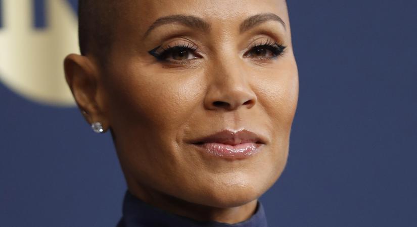 Will Smith feleségének elkezdett visszanőni a haja - Van kiút az alopecia areatából