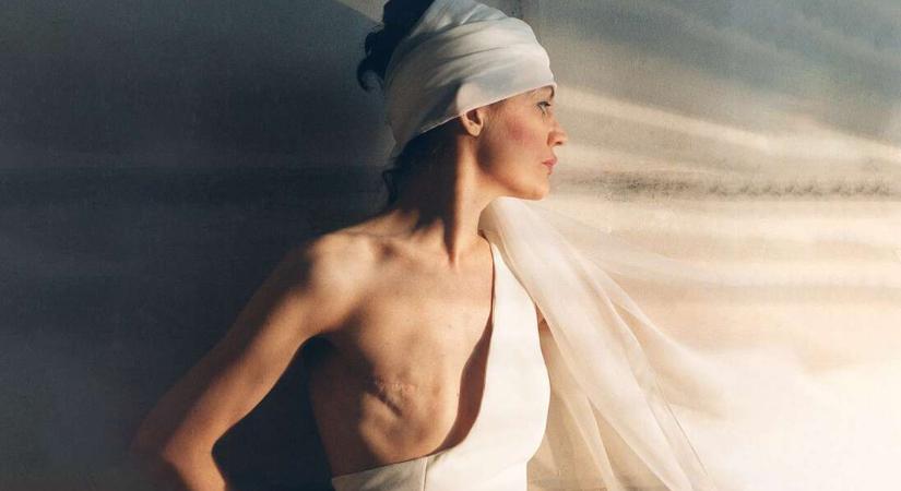 „Ez a fotó talán illetlen. De mellrákban meghalni még illetlenebb”