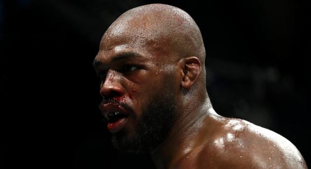 Jon Jones megsérült, oda az év egyik legjobban várt mérkőzése