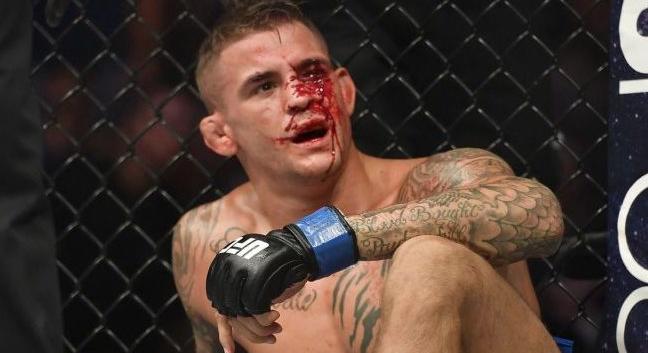 Dustin Poirier kihívta Justin Gaethje-t egy trilógiára