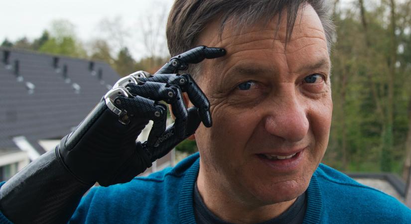 A gondolatainkkal irányítani a gépet – szép álmok és véres valóság a Neuralink története