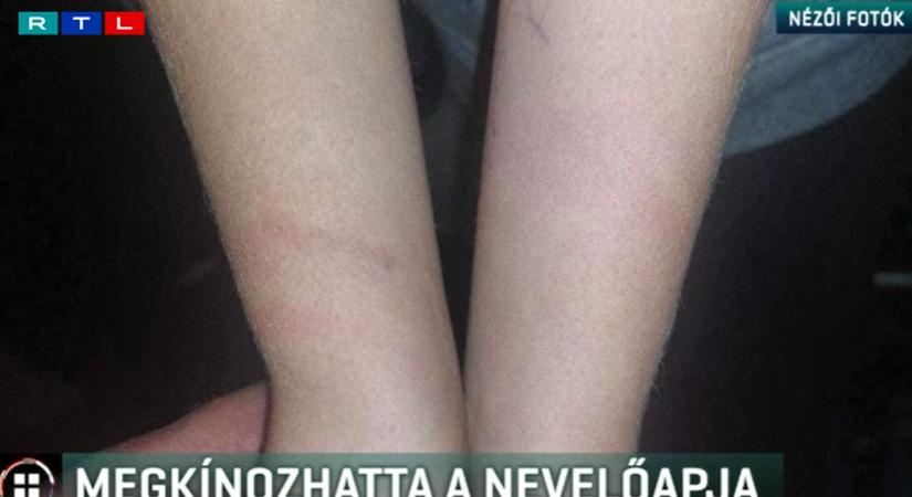 Büntetésből gázolajos rongyot tömött a 12 éves nevelt fia szájába, majd kikötözte egy gerendához