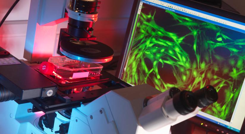 Biztatóak az őssejtterápia korai eredményei a sclerosis multiplex kezelésében