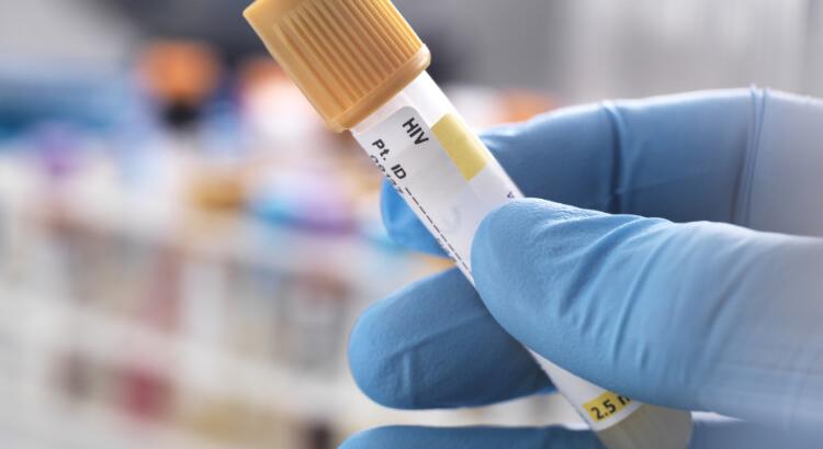 „A HIV egy halálos vírus” – veszélyes tévhitek a HIV-ről és az AIDS-ről