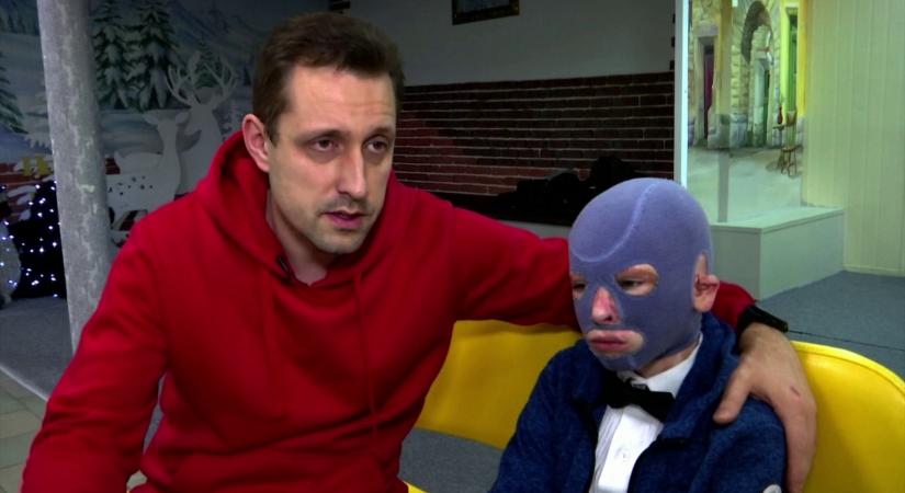 Radar - Felépült az orosz támadásban súlyosan megsérült ukrán kisfiú  videó
