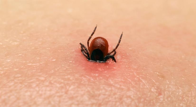 A Lyme-kór korai jelei: ha ezeket a tüneteket észleled, azonnali kezelésre van szükséged