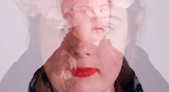 A Down-szindrómás fotómodell megmutatja, hogy a valódi szépség az önazonosság