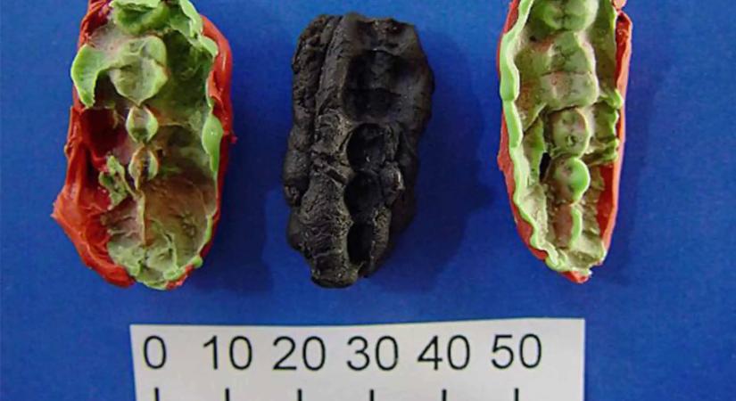 Tízezer éves rágógumi árulkodik a kőkorszaki tinik szájhigiéniájáról