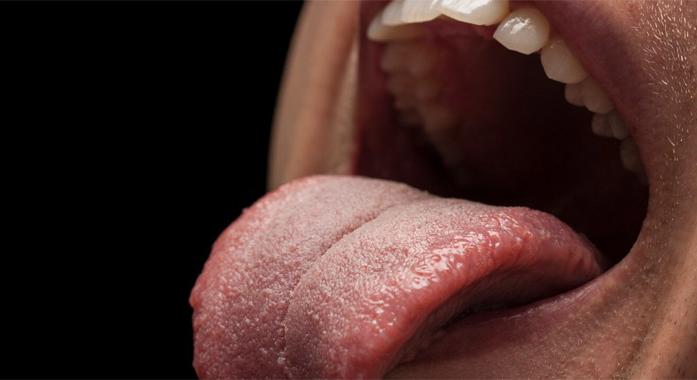 HPV-fertőzés a szájban - Ilyen elváltozásokat okozhat