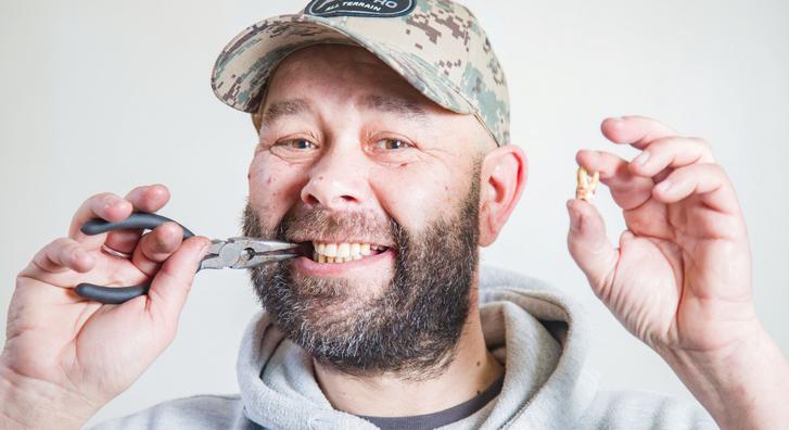 Magának húzta ki a fogát egy 50 éves férfi, miután fél évig nem kapott időpontot a fogorvoshoz