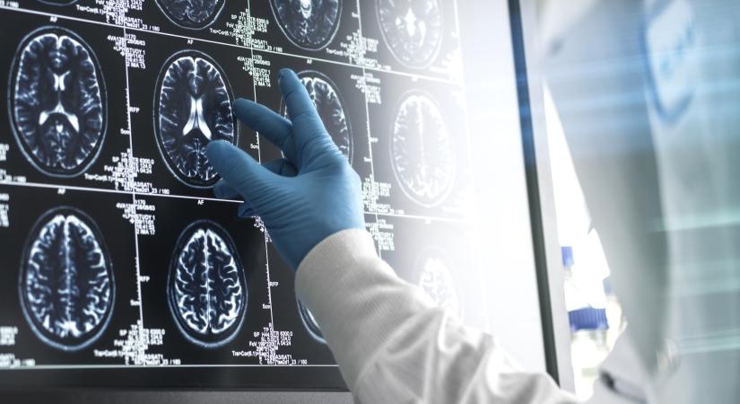 Orvosi csoda: a világon először gyógyult meg egy 13 éves kisfiú az agydaganatból