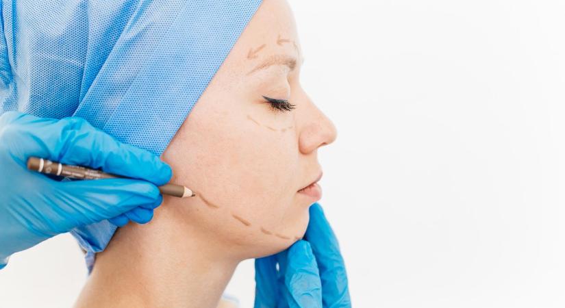 Plasztikai műtétje után fizetés nélkül akart lelépni a klinikáról egy nő – nem zavarta, hogy még kötések borítják az arcát