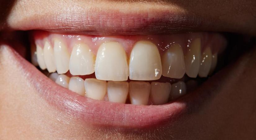 Nem gondoltad volna! A fogorvos szerint erre az öt dologra kell figyelned, ha naponta használsz szájvizet