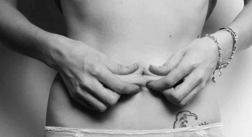 Body shaming, avagy a mérgező testszégyenítés