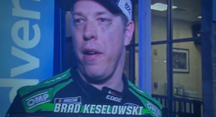 Kiderült, hogy miért éktelenkedett monokli Keselowski szeme alatt a Daytona 500-as balesete után