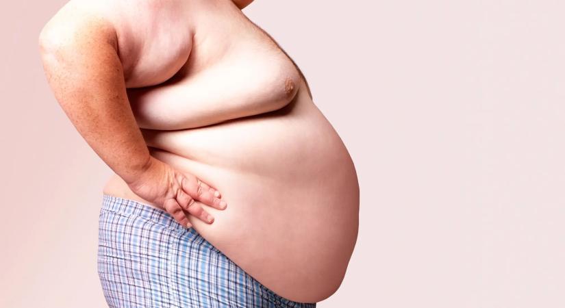 Már több mint 1 milliárd elhízott ember él a Földön