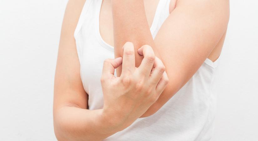 6 tünet, ami májgyulladásra utalhat - a viszkető kiütés az egyik
