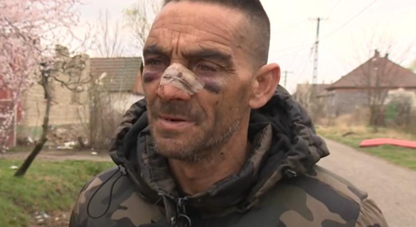 Órákig kínozhattak egy roma férfit Cegléd környékén