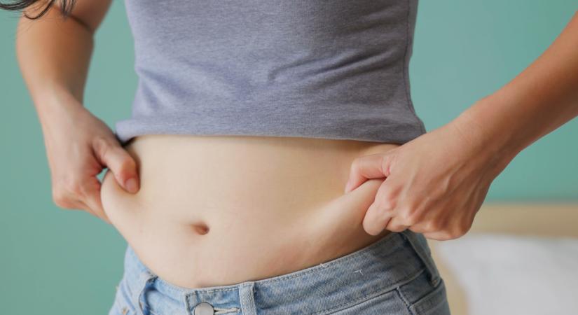 Mikor ajánlott a zsírleszívás, és hogyan segít? – Nem fogyaszt, de átformálja az alakot
