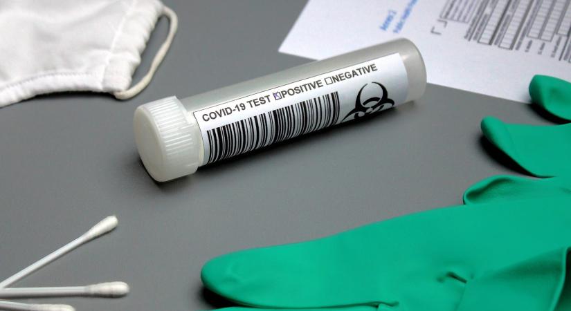 Több mint félmilliárd darab Covid-tesztet venne az Országos Kórházi Főigazgatóság