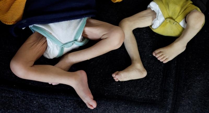 Csontsovány csecsemők – kiszáradás és éhezés miatt halnak meg az emberek a Gázai övezetben