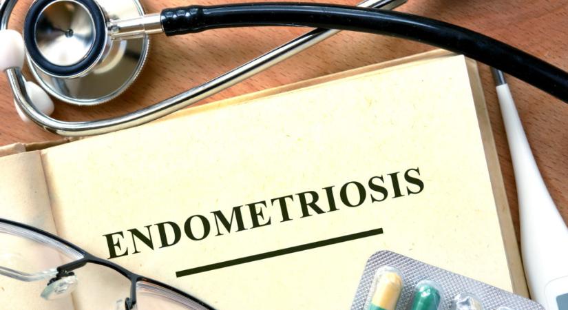 10 évente 1 évet veszítenek az életükből az endometriózissal küzdő nők