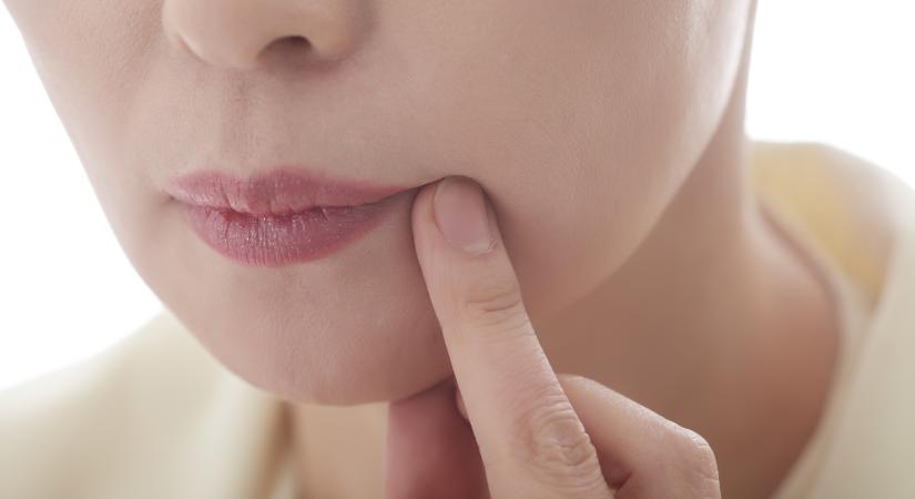 Újabban berepedezik a szájzuga? Ezt az ásványi anyagot hiányolhatja a szervezete