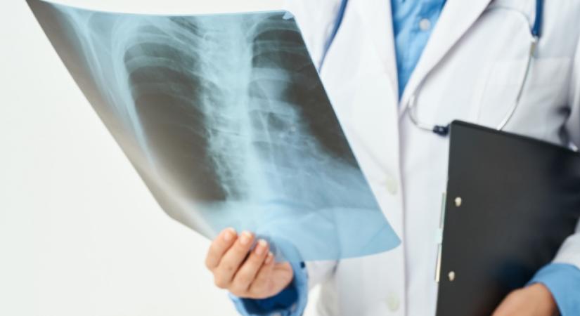 Megdöbbentő dolgot fedezett fel a Z generációs fiatalok röntgenképén az orvos