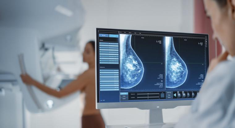Felülmúlta a mesterséges intelligencia az orvosokat a mellrák korai jeleinek észlelésében