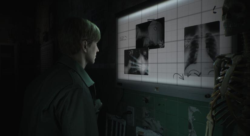 Már a kanyarban lehet a Silent Hill 2 Remake megjelenési dátuma