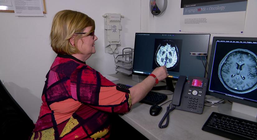 Radar – Hatalmas áttörés az Alzheimer diagnosztikában  videó