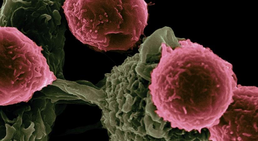 A rák fajtái, amik HPV-vírusfertőzéssel kaphatóak el