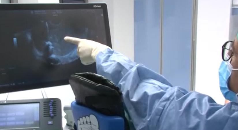 Orvocsi csoda a Semmelweis Egyetem klinikáján: az édesanyja hasában altattak el egy magzatot az életmentő műtéthez - videó