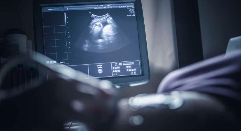 A rettegett amniocentézis és a legújabb genetikai vizsgálatok – minden, amit tudni érdemes