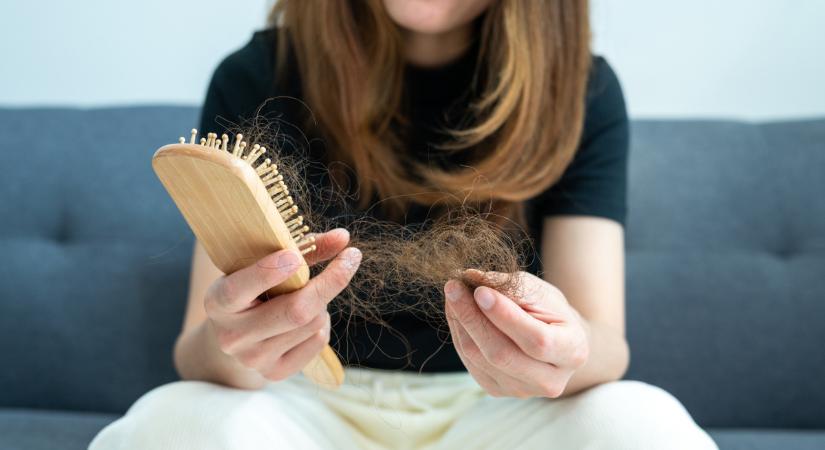 3 frizura, amivel remekül leplezheted a tavaszi hajhullást