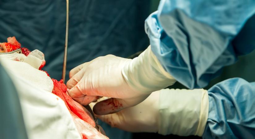 Rendkívüli koponyaműtéteket végeznek a pécsi orvosok