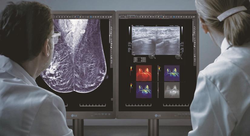 Mammográfiához tervezett diagnosztikai monitort mutat be az LG