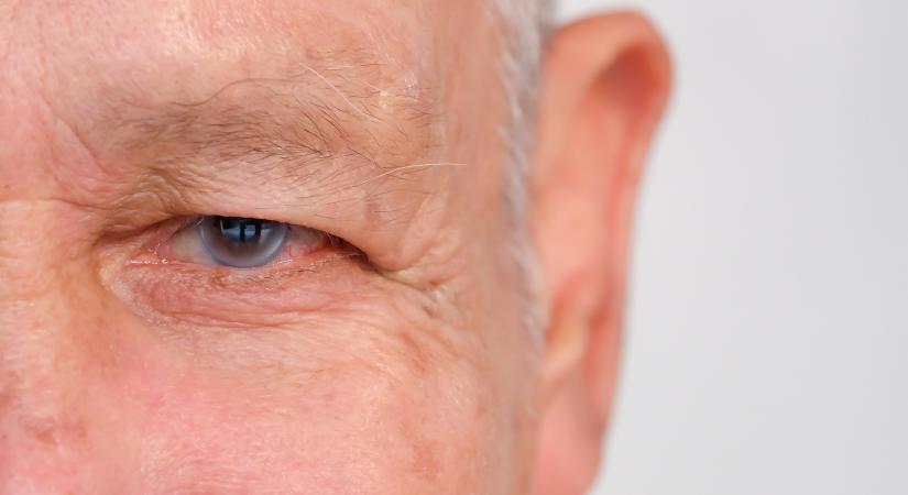 Homályos látás és szemfájdalom: ilyen tünetekkel jelez a zöldhályog
