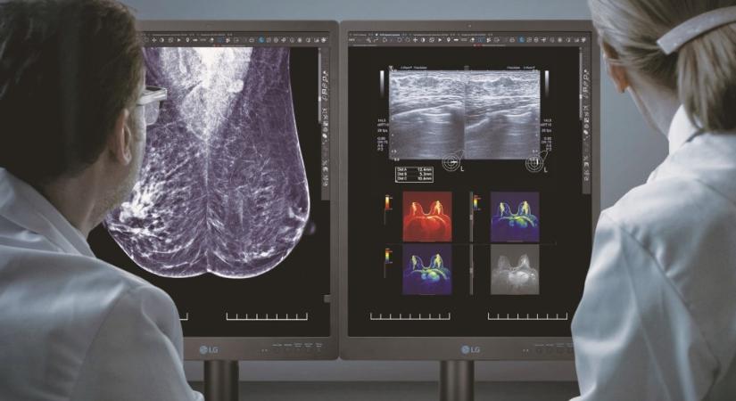 Életet menthet a mammográfiához tervezett új, diagnosztikai monitor