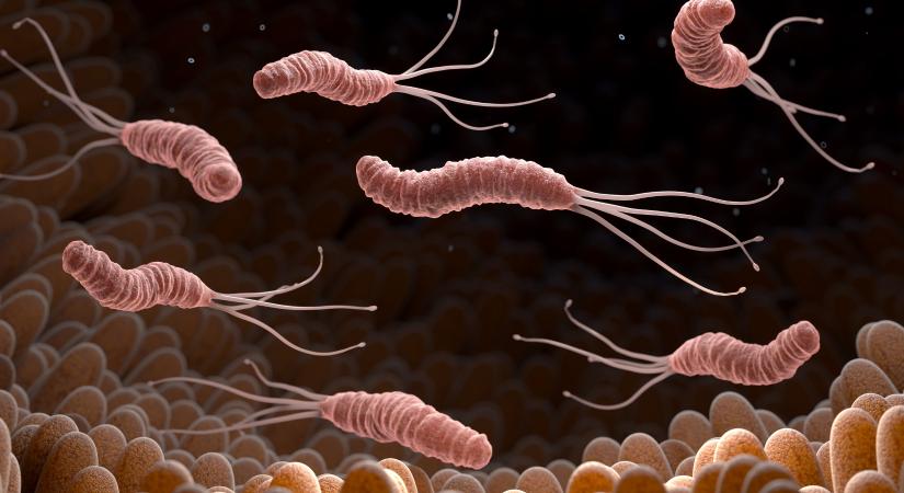 Sok sav és gyomorrák: vígan elél a gyomorban a baktérium, ami ezeket okozza