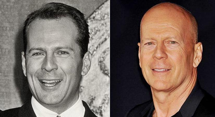 Bruce Willis 20 évig dadogással küzdött, majd felért a csúcsra, 2022-ben pedig végleg visszavonult