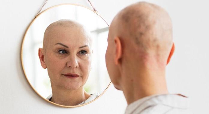 Kemoterápia: a bőr, a haj és a körmök gondozása