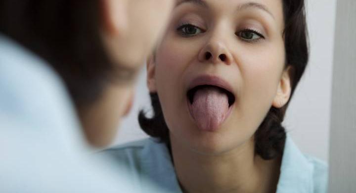 Tumor jele is lehet, ha ilyen a nyelved