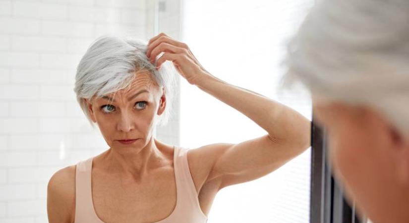 Meddig normális a hajhullás? Szakértők mondják el, mikor érdemes orvoshoz fordulni vele