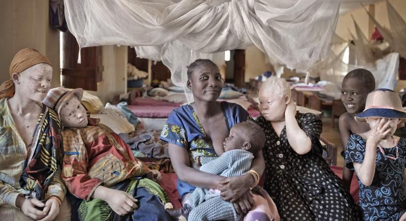 Testrészeikért vadásznak az albínó emberekre Tanzániában - gyerekek is vannak az áldozatok között
