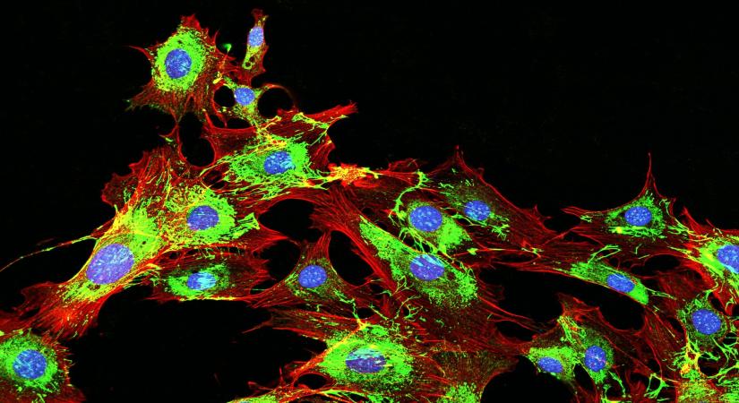 Áttétes tumor: min múlik, hogy a daganat szétterjed-e a szervezetben?