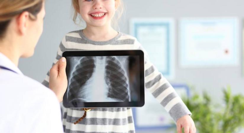 A röntgenorvos nem hitt a szemének: 5 meglepő tárgy, amit gyerekek nyeltek le