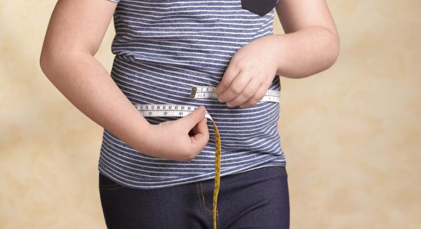 Felére csökkentheti a gyermekek várható élettartamát az elhízás