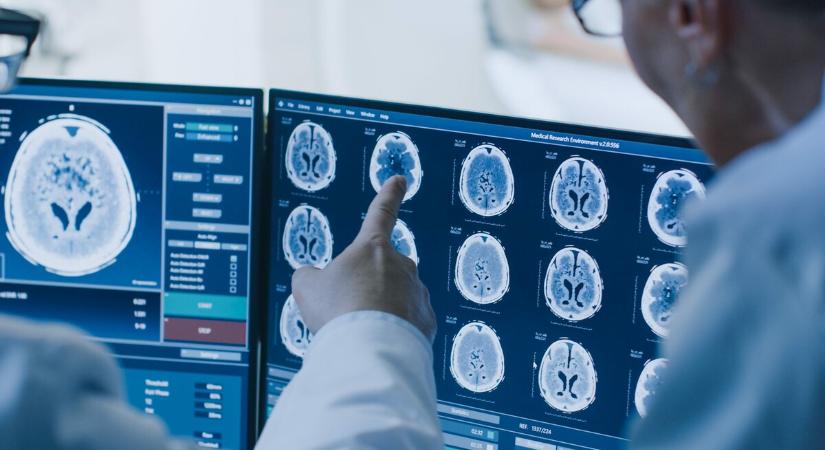 Az agyra ható gyógyszerek tesztelését segítő megoldáson dolgoznak szegedi kutatók