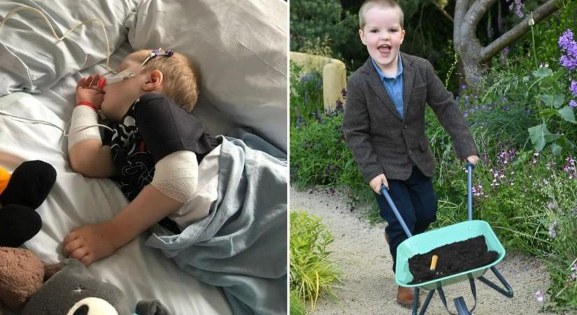 Lebénult a bárányhimlő miatt a 4 éves tündéri Freddie